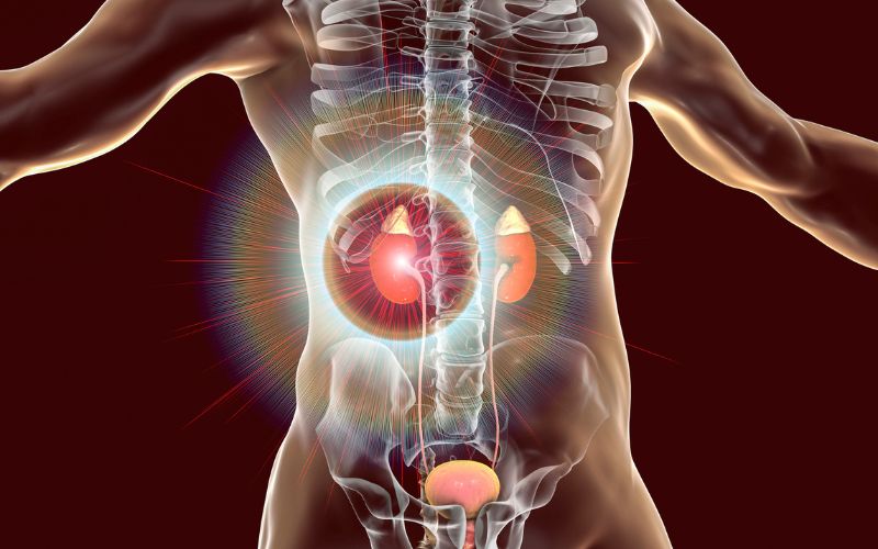 RIRS Surgery in Haryana